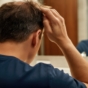 Man examining his hairline in a mirror, concerned about hair loss.