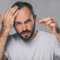 man losing hair