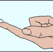 applying treclin graphic