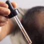 man applying pipette to hair loss