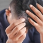 man holding lost hair
