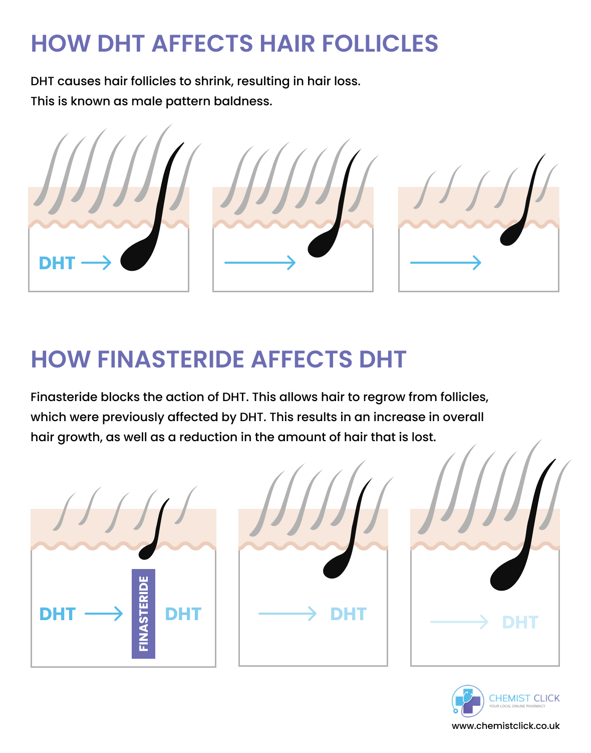 Infographic showing how finasteride works