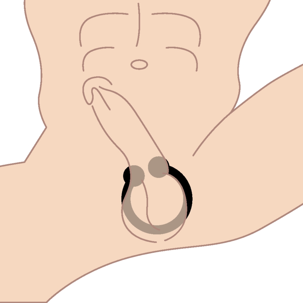 Cock Ring Use