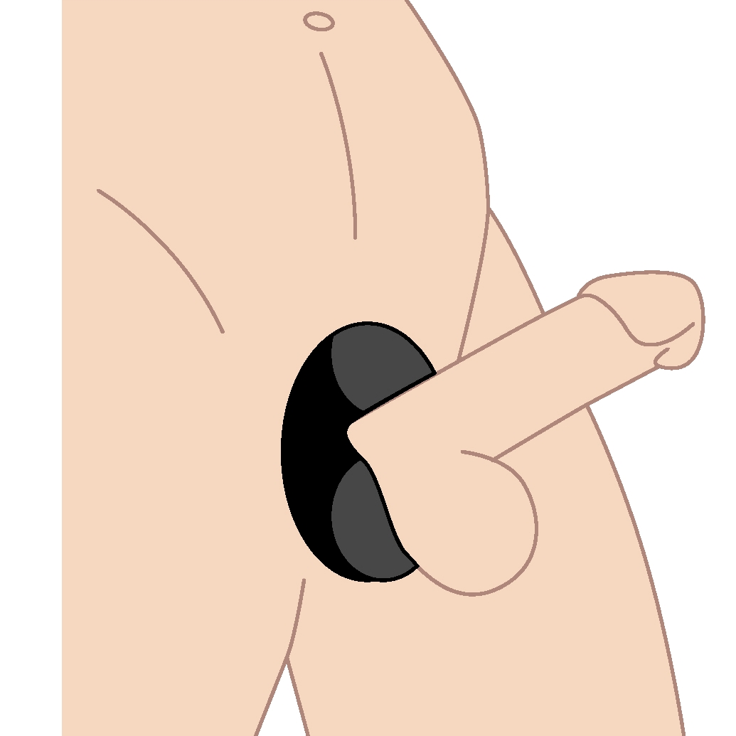 Illustration of cock and ball ring