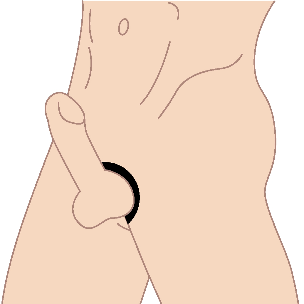 Illustration of metal cock ring