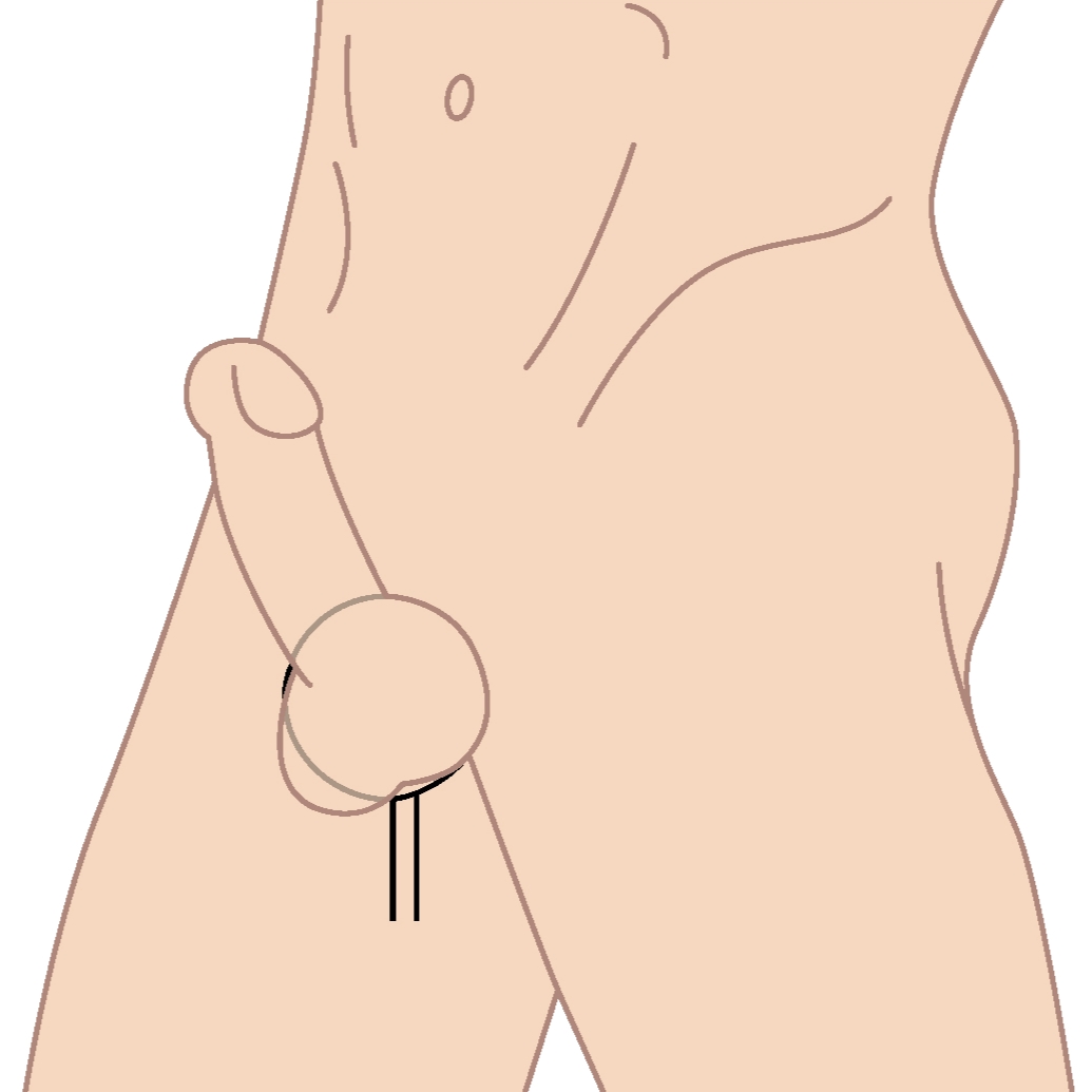 Illustration of silicone cock ring