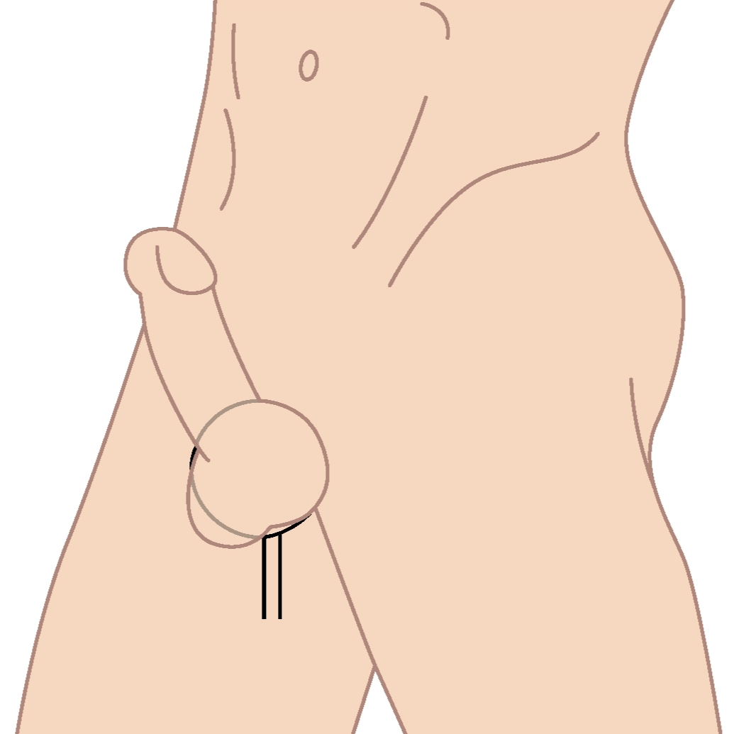 Cock Rings What They Do and How to Use Them image